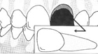 <empty>